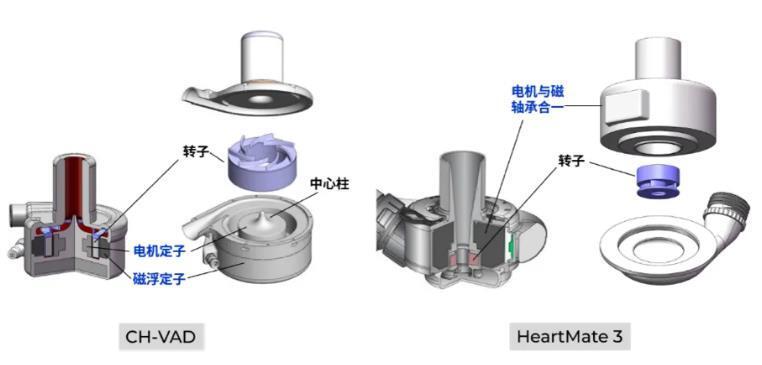 Pg电子平台：拆解同心医疗：器械出海的终极路标人工心脏赛道的“百济时刻”(图2)